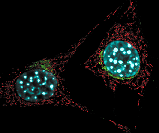 Stained Cells